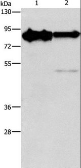 KIF3A Antibody - Western blot analysis of Mouse brain and human brain malignant glioma tissue, using KIF3A Polyclonal Antibody at dilution of 1:750.