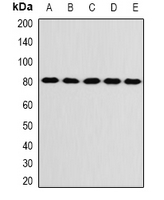 KIF3A Antibody - Western blot analysis of KIF3A expression in SW480 (A); SKOV3 (B); mouse brain (C); mouse ovary (D); rat liver (E) whole cell lysates.