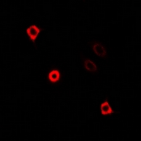 KIF3A Antibody - Immunofluorescent analysis of KIF3A staining in U2OS cells. Formalin-fixed cells were permeabilized with 0.1% Triton X-100 in TBS for 5-10 minutes and blocked with 3% BSA-PBS for 30 minutes at room temperature. Cells were probed with the primary antibody in 3% BSA-PBS and incubated overnight at 4 deg C in a humidified chamber. Cells were washed with PBST and incubated with a DyLight 594-conjugated secondary antibody (red) in PBS at room temperature in the dark.