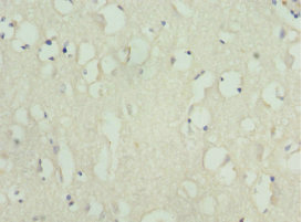 KIF3A Antibody - Immunohistochemistry of paraffin-embedded human brain tissue at dilution 1:100