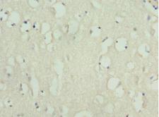 KIF3A Antibody - Immunohistochemistry of paraffin-embedded human brain tissue at dilution 1:100