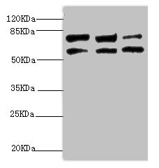 KIF3A Antibody - Western blot All Lanes:KIF3A antibody at 9.45ug/ml Lane 1:MCF-7 whole cell lysate Lane 2:Rat gonad tissue Lane 3:293T whole cell lysate Secondary Goat polyclonal to rabbit at 1/10000 dilution Predicted band size: 80kDa Observed band size: 80kDa,60kDa (We are unsure as to the identity of this extra band)