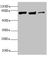 KIF3A Antibody - Western blot All lanes: KIF3A antibody at 9.45µg/ml Lane 1: MCF-7 whole cell lysate Lane 2: Rat gonad tissue Lane 3: 293T whole cell lysate Secondary Goat polyclonal to rabbit IgG at 1/10000 dilution Predicted band size: 80 kDa Observed band size: 80 kDa