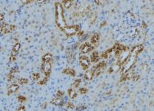 KIF3A Antibody - 1:100 staining mouse kidney tissue by IHC-P. The sample was formaldehyde fixed and a heat mediated antigen retrieval step in citrate buffer was performed. The sample was then blocked and incubated with the antibody for 1.5 hours at 22°C. An HRP conjugated goat anti-rabbit antibody was used as the secondary.