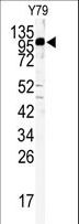 KIF3C Antibody - Western blot of KIF3C antibody in Y79 cell line lysates (35 ug/lane). HGK (arrow) was detected using the purified antibody.
