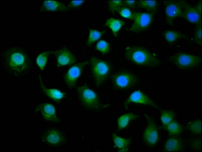 KIF3C Antibody - Immunofluorescence staining of A549 cells diluted at 1:200, counter-stained with DAPI. The cells were fixed in 4% formaldehyde, permeabilized using 0.2% Triton X-100 and blocked in 10% normal Goat Serum. The cells were then incubated with the antibody overnight at 4°C.The Secondary antibody was Alexa Fluor 488-congugated AffiniPure Goat Anti-Rabbit IgG (H+L).