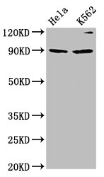KIF3C Antibody - Western Blot Positive WB detected in: Hela whole cell lysate, K562 whole cell lysate All Lanes: KIF3C antibody at 4.2µg/ml Secondary Goat polyclonal to rabbit IgG at 1/50000 dilution Predicted band size: 90 KDa Observed band size: 90 KDa