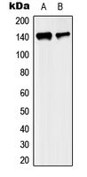 KIF4A Antibody - Western blot analysis of KIF4A expression in MCF7 (A); SP2/0 (B) whole cell lysates.