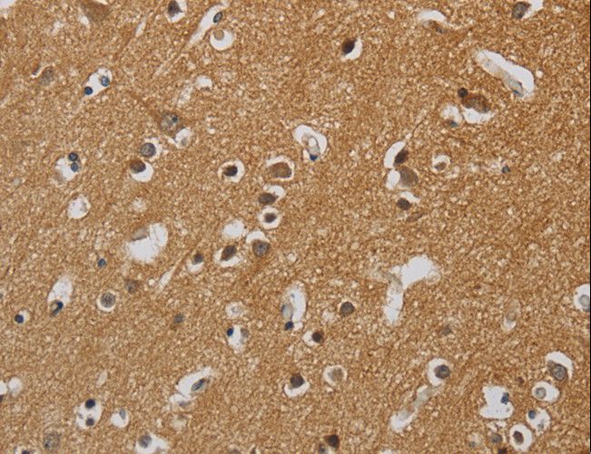 KIF4A Antibody - Immunohistochemistry of paraffin-embedded Human brain using KIF4A Polyclonal Antibody at dilution of 1:40.