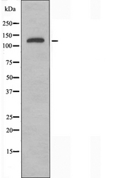 KIF4A Antibody - Western blot analysis of extracts of HeLa cells using KIF4A antibody.