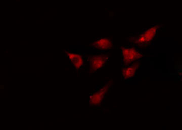 KIF4A Antibody - Staining HeLa cells by IF/ICC. The samples were fixed with PFA and permeabilized in 0.1% Triton X-100, then blocked in 10% serum for 45 min at 25°C. The primary antibody was diluted at 1:200 and incubated with the sample for 1 hour at 37°C. An Alexa Fluor 594 conjugated goat anti-rabbit IgG (H+L) antibody, diluted at 1/600, was used as secondary antibody.