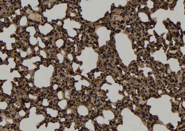 KIF4B Antibody - 1:100 staining mouse lung tissue by IHC-P. The sample was formaldehyde fixed and a heat mediated antigen retrieval step in citrate buffer was performed. The sample was then blocked and incubated with the antibody for 1.5 hours at 22°C. An HRP conjugated goat anti-rabbit antibody was used as the secondary.