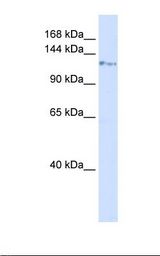 KIF5C Antibody - Placenta lysate. Antibody concentration: 1.0 ug/ml. Gel concentration: 6-18%.  This image was taken for the unconjugated form of this product. Other forms have not been tested.