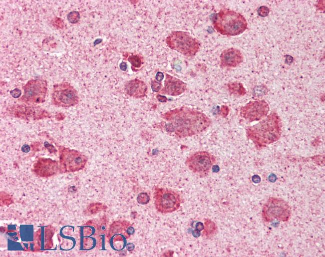 KIF5C Antibody - Anti-KIF5C antibody IHC staining of human brain, cortex. Immunohistochemistry of formalin-fixed, paraffin-embedded tissue after heat-induced antigen retrieval. Antibody concentration 10 ug/ml.  This image was taken for the unconjugated form of this product. Other forms have not been tested.