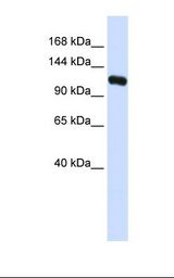 KIF5C Antibody - Fetal brain lysate. Antibody concentration: 1.0 ug/ml. Gel concentration: 6-18%.  This image was taken for the unconjugated form of this product. Other forms have not been tested.