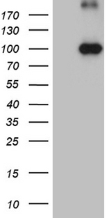 KIF6 Antibody - HEK293T cells were transfected with the pCMV6-ENTRY control. (Left lane) or pCMV6-ENTRY KIF6. (Right lane) cDNA for 48 hrs and lysed. Equivalent amounts of cell lysates. (5 ug per lane) were separated by SDS-PAGE and immunoblotted with anti-KIF6. (1:2000)