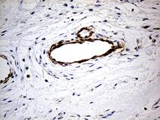 KIF6 Antibody - Immunohistochemical staining of paraffin-embedded Human breast tissue within the normal limits using anti-KIF6 mouse monoclonal antibody. (Heat-induced epitope retrieval by 1mM EDTA in 10mM Tris buffer. (pH8.5) at 120°C for 3 min. (1:500)