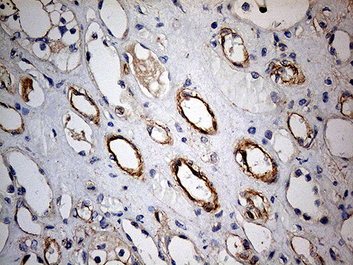 KIF6 Antibody - Immunohistochemical staining of paraffin-embedded Human Kidney tissue within the normal limits using anti-KIF6 mouse monoclonal antibody. (Heat-induced epitope retrieval by 1mM EDTA in 10mM Tris buffer. (pH8.5) at 120°C for 3 min. (1:500)