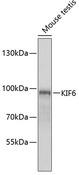 KIF6 Antibody - Western blot analysis of extracts of mouse testis using KIF6 Polyclonal Antibody at dilution of 1:1000.