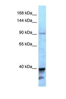 KIF7 Antibody - KIF7 antibody Western blot of A549 Cell lysate. Antibody concentration 1 ug/ml.  This image was taken for the unconjugated form of this product. Other forms have not been tested.