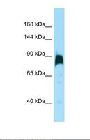 KIF7 Antibody - Western blot of Human HT1080. KIF7 antibody dilution 1.0 ug/ml.  This image was taken for the unconjugated form of this product. Other forms have not been tested.