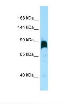 KIF7 Antibody - Western blot of Human HT1080. KIF7 antibody dilution 1.0 ug/ml.  This image was taken for the unconjugated form of this product. Other forms have not been tested.