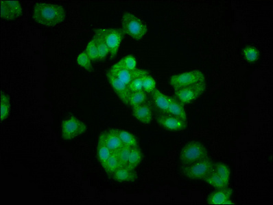KIFAP3 / KAP3 Antibody - Immunofluorescence staining of HepG2 cells at a dilution of 1:133, counter-stained with DAPI. The cells were fixed in 4% formaldehyde, permeabilized using 0.2% Triton X-100 and blocked in 10% normal Goat Serum. The cells were then incubated with the antibody overnight at 4 °C.The secondary antibody was Alexa Fluor 488-congugated AffiniPure Goat Anti-Rabbit IgG (H+L) .