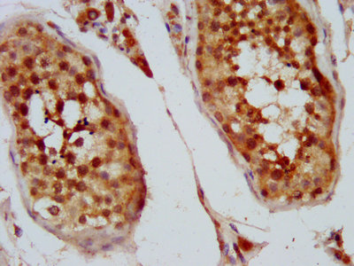KIFAP3 / KAP3 Antibody - IHC image of KIFAP3 Antibody diluted at 1:400 and staining in paraffin-embedded human testis tissue performed on a Leica BondTM system. After dewaxing and hydration, antigen retrieval was mediated by high pressure in a citrate buffer (pH 6.0). Section was blocked with 10% normal goat serum 30min at RT. Then primary antibody (1% BSA) was incubated at 4°C overnight. The primary is detected by a biotinylated secondary antibody and visualized using an HRP conjugated SP system.