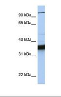KIFC3 Antibody - MCF7 cell lysate. Antibody concentration: 1.0 ug/ml. Gel concentration: 12%.  This image was taken for the unconjugated form of this product. Other forms have not been tested.