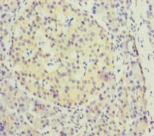 KIFC3 Antibody - Immunohistochemistry of paraffin-embedded human pancreatic tissue at dilution of 1:100