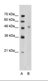 KIN17 / KIN Antibody - Jurkat Cell Lysate.  This image was taken for the unconjugated form of this product. Other forms have not been tested.