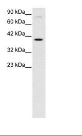 KIN17 / KIN Antibody - HepG2 Cell Lysate.  This image was taken for the unconjugated form of this product. Other forms have not been tested.