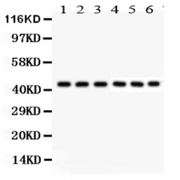 KIN17 / KIN Antibody - KIN antibody Western blot. All lanes: Anti KIN at 0.5 ug/ml. Lane 1: HELA Whole Cell Lysate at 40 ug. Lane 2: 22RV1 Whole Cell Lysate at 40 ug. Lane 3: COLO320 Whole Cell Lysate at 40 ug. Lane 4: MCF-7 Whole Cell Lysate at 40 ug. Lane 5: U20S Whole Cell Lysate at 40 ug. Lane 6: NIH3T3 Whole Cell Lysate at 40 ug. Predicted band size: 45 kD. Observed band size: 45 kD.