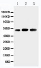 KIN17 / KIN Antibody - WB of KIN17 / KIN antibody. Lane 1: Rat Skeletal Muscle Tissue Lysate. Lane 2: Human Placenta Tissue Lysate. Lane 3: Rat Testis Tissue Lysate.