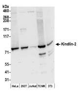 KIND2 / FERMT2 Antibody - Detection of human and mouse Kindlin-2 by western blot. Samples: Whole cell lysate (50 µg) from HeLa, HEK293T, Jurkat, mouse TCMK-1, and mouse NIH 3T3 cells prepared using NETN lysis buffer. Antibodies: Affinity purified rabbit anti-Kindlin-2 antibody used for WB at 0.1 µg/ml. Detection: Chemiluminescence with an exposure time of 30 seconds.