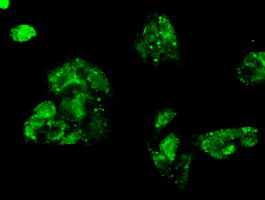 KIND2 / FERMT2 Antibody - Immunofluorescent staining of HepG2 cells using anti-FERMT2 mouse monoclonal antibody.