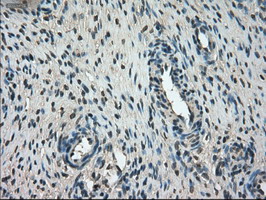 KIND2 / FERMT2 Antibody - IHC of paraffin-embedded Ovary tissue using anti-FERMT2 mouse monoclonal antibody. (Dilution 1:50).