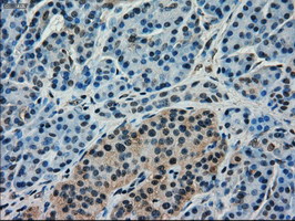 KIND2 / FERMT2 Antibody - IHC of paraffin-embedded pancreas tissue using anti-FERMT2 mouse monoclonal antibody. (Dilution 1:50).