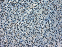 KIND2 / FERMT2 Antibody - IHC of paraffin-embedded pancreas tissue using anti-FERMT2 mouse monoclonal antibody. (Dilution 1:50).