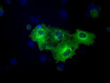 KIND2 / FERMT2 Antibody - Anti-FERMT2 mouse monoclonal antibody  immunofluorescent staining of COS7 cells transiently transfected by pCMV6-ENTRY FERMT2.