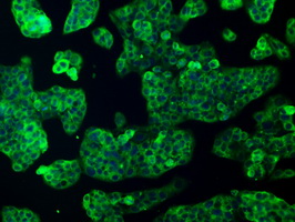 KIND2 / FERMT2 Antibody - Immunofluorescent staining of HeLa cells using anti-FERMT2 mouse monoclonal antibody.