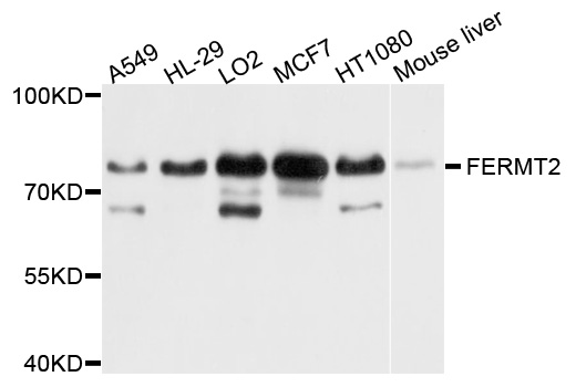 KIND2 / FERMT2 Antibody - Western blot analysis of extract of various cells.