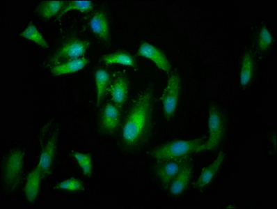 KIND2 / FERMT2 Antibody - Immunofluorescence staining of Hela cells at a dilution of 1:166, counter-stained with DAPI. The cells were fixed in 4% formaldehyde, permeabilized using 0.2% Triton X-100 and blocked in 10% normal Goat Serum. The cells were then incubated with the antibody overnight at 4 °C.The secondary antibody was Alexa Fluor 488-congugated AffiniPure Goat Anti-Rabbit IgG (H+L) .