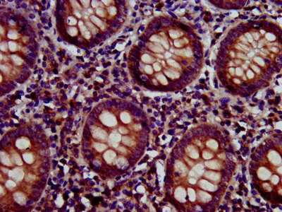 KIND2 / FERMT2 Antibody - Immunohistochemistry image at a dilution of 1:500 and staining in paraffin-embedded human appendix tissue performed on a Leica BondTM system. After dewaxing and hydration, antigen retrieval was mediated by high pressure in a citrate buffer (pH 6.0) . Section was blocked with 10% normal goat serum 30min at RT. Then primary antibody (1% BSA) was incubated at 4 °C overnight. The primary is detected by a biotinylated secondary antibody and visualized using an HRP conjugated SP system.