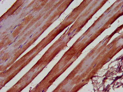 KIND2 / FERMT2 Antibody - Immunohistochemistry image at a dilution of 1:500 and staining in paraffin-embedded human skeletal muscle tissue performed on a Leica BondTM system. After dewaxing and hydration, antigen retrieval was mediated by high pressure in a citrate buffer (pH 6.0) . Section was blocked with 10% normal goat serum 30min at RT. Then primary antibody (1% BSA) was incubated at 4 °C overnight. The primary is detected by a biotinylated secondary antibody and visualized using an HRP conjugated SP system.