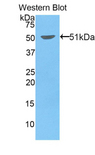 Kinesin 5A / KIF5A Antibody - Western blot of recombinant Kinesin 5A / KIF5A.  This image was taken for the unconjugated form of this product. Other forms have not been tested.