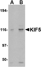 Kinesin 5A / KIF5A Antibody - Western blot of KIF5 in K562 cell lysate with KIF5 antibody at (A) 0.5 and (B) 1 ug/ml.