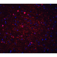 Kinesin 5A / KIF5A Antibody - Immunofluorescence of KIF5 in mouse brain tissue with KIF5 antibody at 20 µg/mL.Red: KIF5 Antibody  Blue: DAPI staining