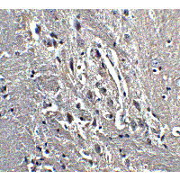 Kinesin 5A / KIF5A Antibody - Immunohistochemistry of KIF5 in mouse brain tissue with KIF5 antibody at 5 µg/ml.