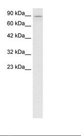 Kinesin Heavy Chain / KIF5B Antibody - Fetal Brain Lysate.  This image was taken for the unconjugated form of this product. Other forms have not been tested.